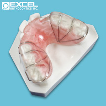 Posterior Bite Plate - Excel Orthodontics