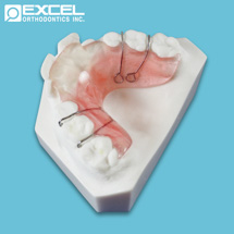 Anterior Bite Plate - Excel Orthodontics