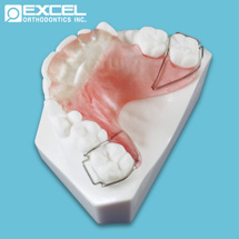 Anterior Bite Plate - Excel Orthodontics