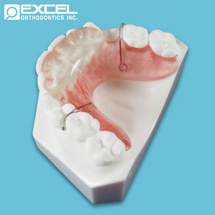 Anterior Bite Plate - Excel Orthodontics