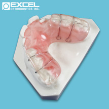 Posterior Bite Plate - Excel Orthodontics