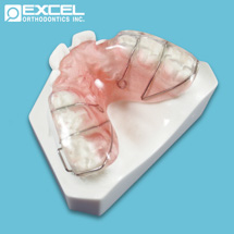 Posterior Bite Plate - Excel Orthodontics