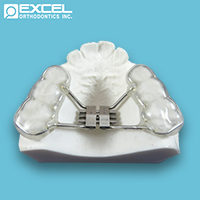 Expanders - Excel Orthodontics