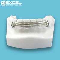 Bow Options - Excel Orthodontics