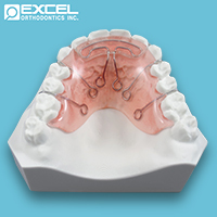 Spring Retainers - Excel Orthodontics