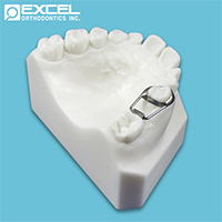 Holding Appliances - Excel Orthodontics