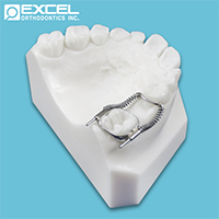 Holding Appliances - Excel Orthodontics