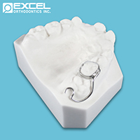 Holding Appliances - Excel Orthodontics