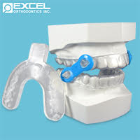 Splints - Excel Orthodontics